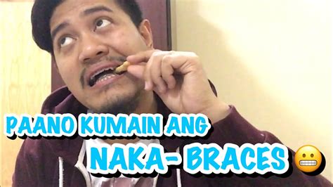 nilasing saka iniskoran si ate naka brace|Nilasing saka iniskoran si ate naka brace .